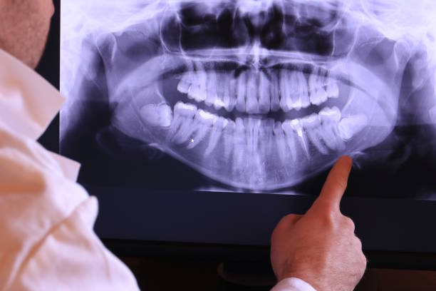 Best Emergency Broken Tooth Repair in Cisco, TX