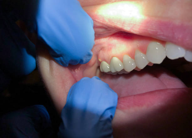 Best Emergency Dental Care for Trauma or Injury in Cisco, TX