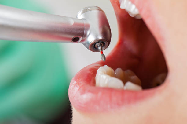 Best After-Hours Emergency Dentist in Cisco, TX